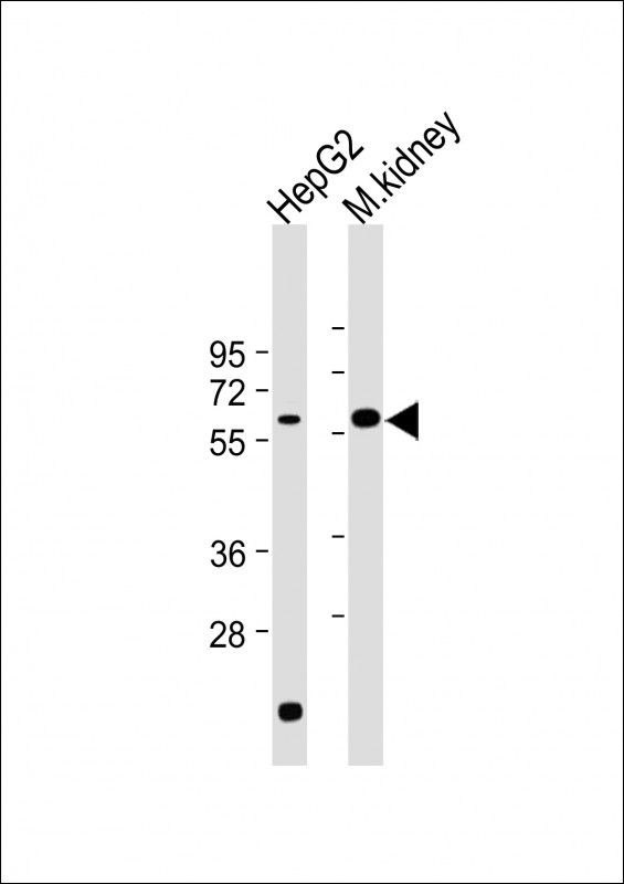 WB - CAT Antibody (Center) AP8623c